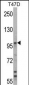 UBE3A Antibody (C-term)