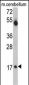 UBE2V1 Antibody (C-term)