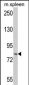 HGS Antibody (N-term)