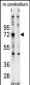 Ubiquilin1 Antibody (N-term)
