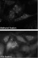 SQSTM1 (p62) Antibody (C-term)