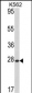 ARL1 Antibody (N-term)