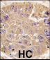 Methionine Aminopeptidase 2 (METAP2) Antibody (C-term)