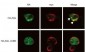 AGL Antibody (C-term)