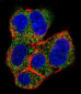 AGL Antibody (C-term)