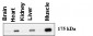 AGL Antibody (C-term)