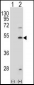 FDFT1 Antibody (Center)