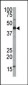 FNTA Antibody (Center)