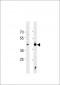 HSF1 Sumoylation Site Antibody