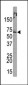 PML Sumoylation Site Antibody