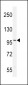 Androgen Receptor (ANDR) Antibody