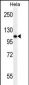 Androgen Receptor (ANDR) Antibody