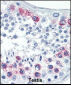 EZH2 Antibody (Center)