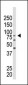 EZH2 Antibody (Center)