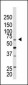 PC2 (CBX4) Antibody (N-term)