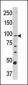 CPT1A Antibody (C-term)