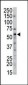 Serine Palmitoyltransferase (SPTLC2) Antibody (C-term)