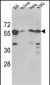 SPTLC1 Antibody (N-term)