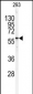 SPTLC1 Antibody (C-term)