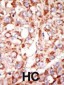 ACSL3 (FACL3) Antibody (N-term)
