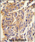 PPT1 Antibody (C-term)