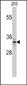 PPT1 Antibody (C-term)