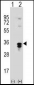 PPT1 Antibody (C-term)