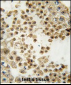 ACE2 (NCOVID / SARS Receptor) Antibody (N-term)