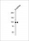 ACE2 (NCOVID / SARS Receptor) Antibody (Center)