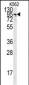 ACE2 (NCOVID/SARS Receptor) Antibody (C-term)