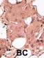 BACE1B Antibody (Center)