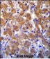 ABCB10 Antibody (N-term)