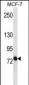 ABCB10 Antibody (N-term)