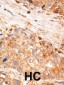 BIRC7 Antibody (C-term)