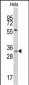 MAGEA1 Antibody (Center)