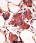 MAGEA9 Antibody (Center)