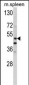 MMP10 Antibody (C-term)