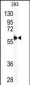 MMP11 Antibody (C-term)