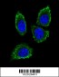 MMP12 Antibody (C-term)