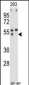 MMP12 Antibody (C-term)