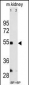 MMP12 Antibody (C-term)