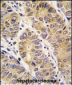 MMP13 Antibody (C-term)