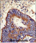 MMP15 Antibody (N-term)