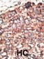 MMP17 Antibody (Center)