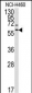 MMP17 Antibody (Center)