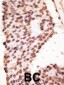 MMP7 Antibody (Center)