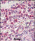 MMP9 Antibody (C-term)