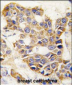 MMP9 Antibody (C-term)