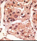 Presenilin 1 Antibody (C-term) [Knockout Validated]