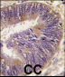 HSC70 Interacting Protein HIP (ST13) Antibody